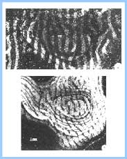 ALTERA��ES PERMANENTES NA ORGANIZA��O CELULAR E CORPO GENICULADO LATERAL