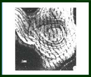 PERDA DE C&Eacute;LULAS NO C&Oacute;RTEX VISUAL