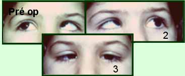 Pr�-operat�rio da crian&ccedil;a olhando para cima