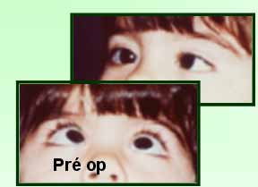 Pr&eacute;-operat&oacute;rio da crian&ccedil;a olhando para cima