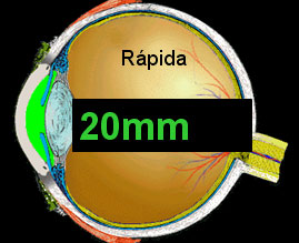 comprimento axial depois de um ano