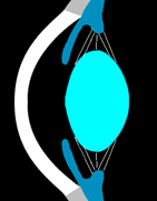 comprimento axial depois de um ano