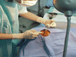 Foto 
          do Serviço de Oftalmologia, cirurgia