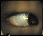 estruturas do segmento anterior