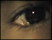 Achados extra-oculares